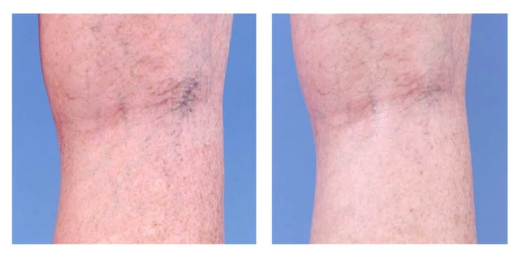 Correzione cosmetica